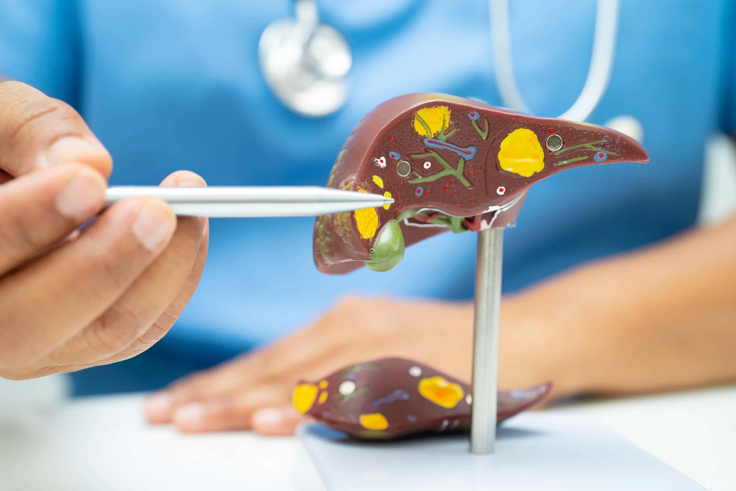 Signs Fatty Liver May Be More Advanced: Symptoms That Deserve Prompt Medical Attention